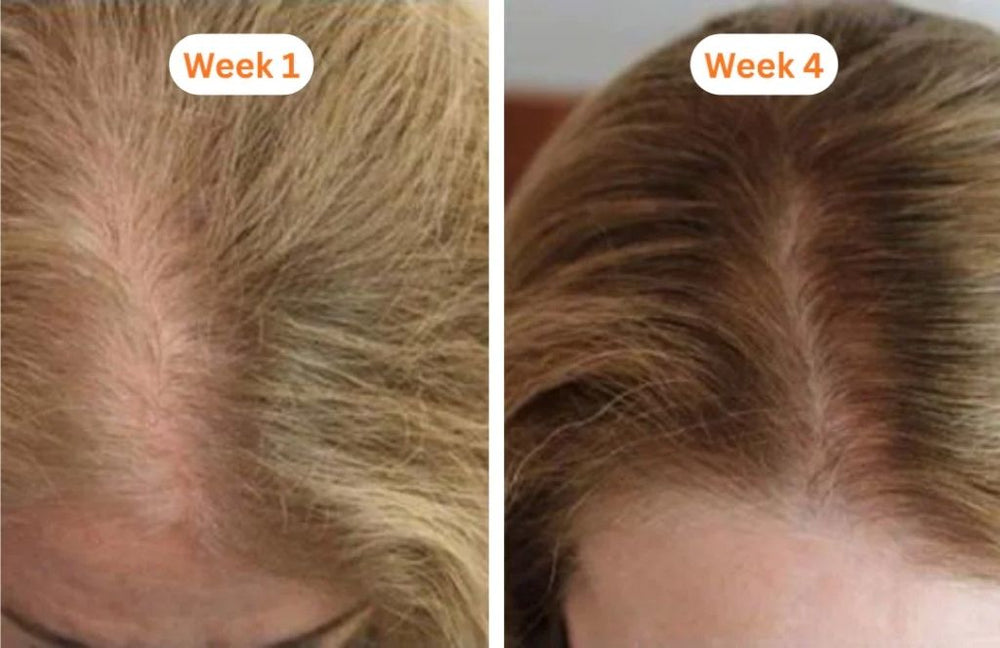 Customer result 5