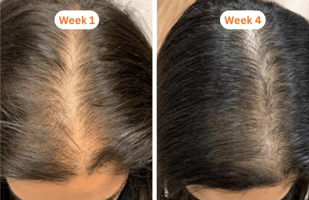 Real hair result week 7
