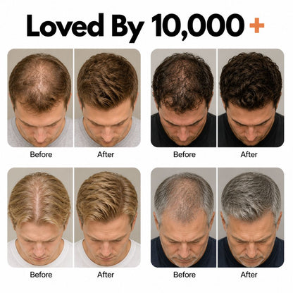 Korea's #1 Hair Growth Serum